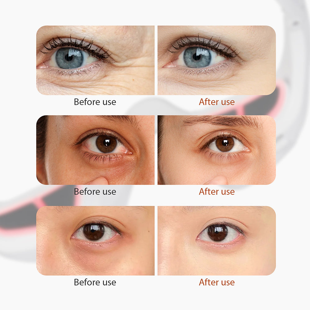 Eye Massager with Four Modes and Red Light for Wearable Relaxation