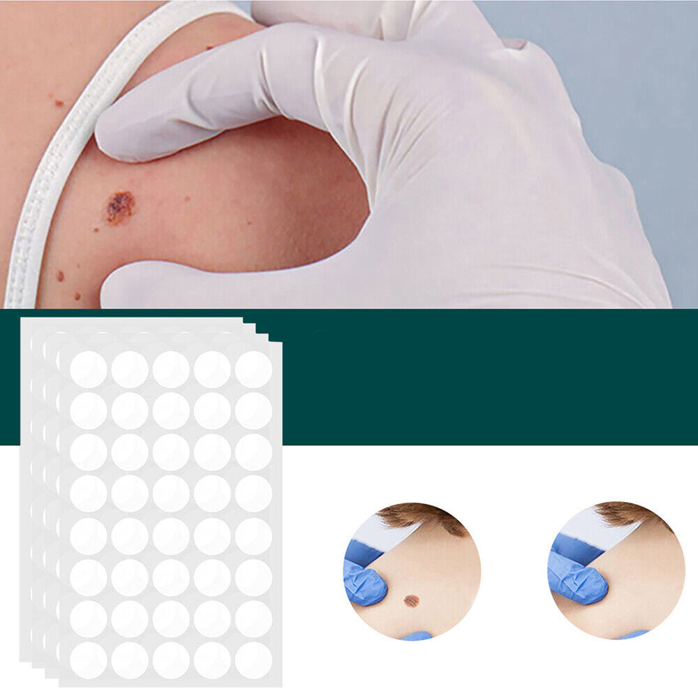 Skin Treatment Patches for Spot and Wart Removal – Discreet Design