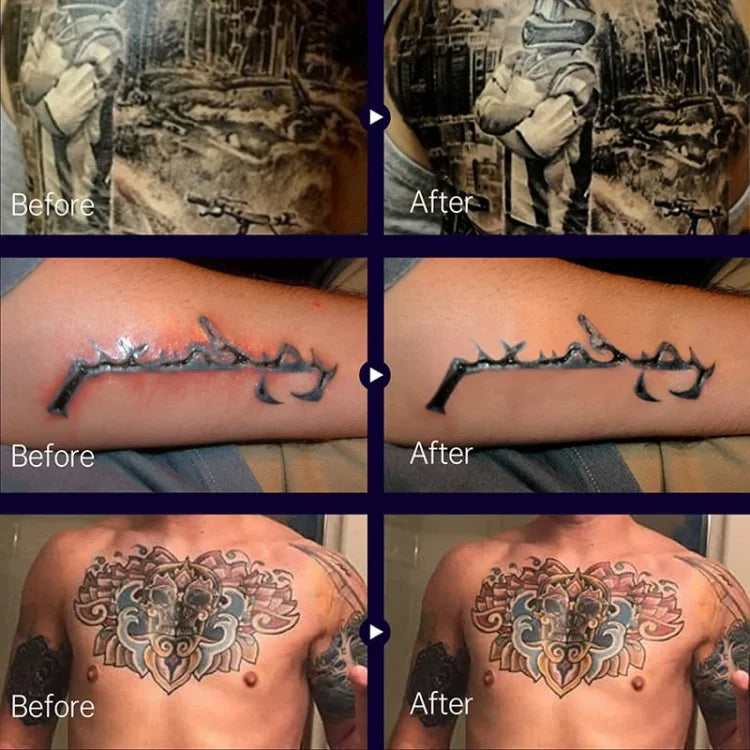 VividAura™ — Ignite Your Tattoos with Unstoppable Color and Soothing Healing Power