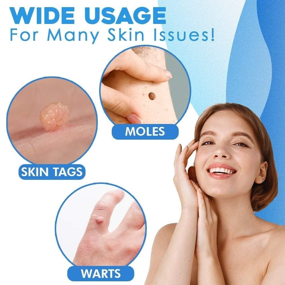 CircuLuxe™ — Pain-Free Skin Tag Removal for Instant Confidence and Clear, Radiant Skin