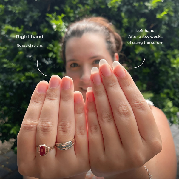 NailVanta™ — Unlock Unshakable Strength and Radiant Nails That Command Attention