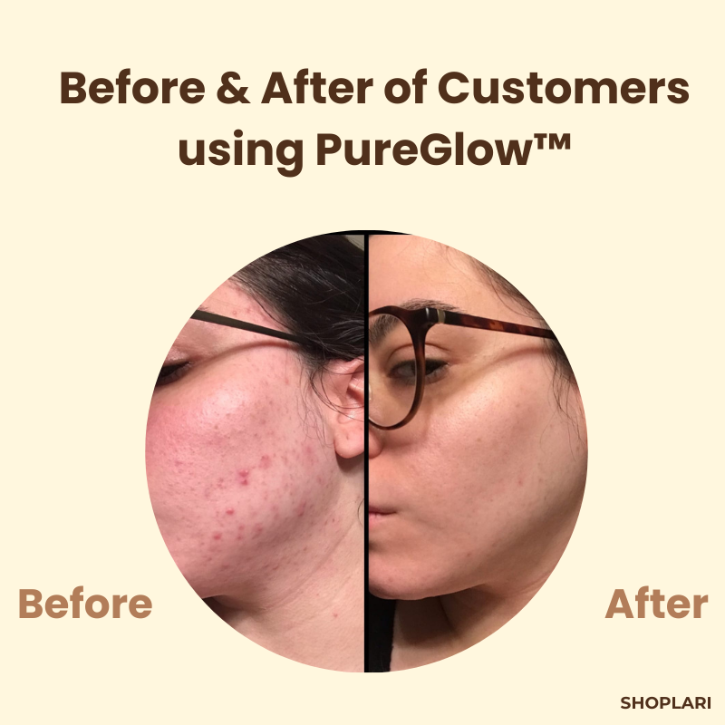 VibranceVail™ Black Tea Mask — Clear Away Blemishes and Glow with Unstoppable Confidence