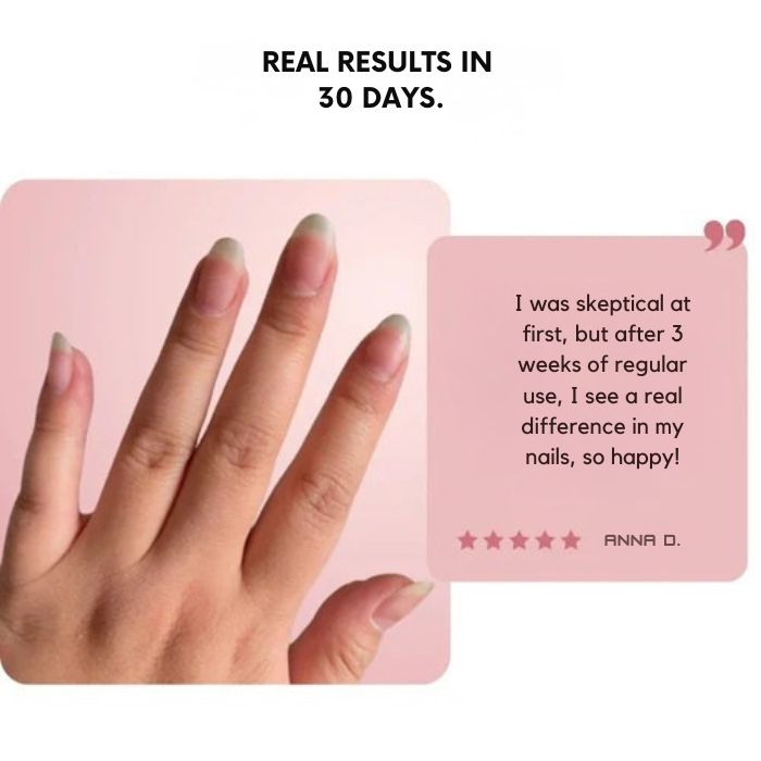 NailVanta™ — Unlock Unshakable Strength and Radiant Nails That Command Attention