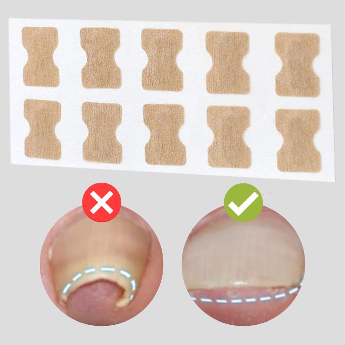 OrthoNailPro™ — Effortless Relief & Confident Feet Without Pain or Shame