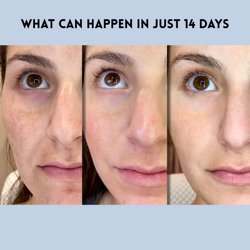 LiftEase™ — Instantly Smooth and Lift Your Skin for Lasting Confidence