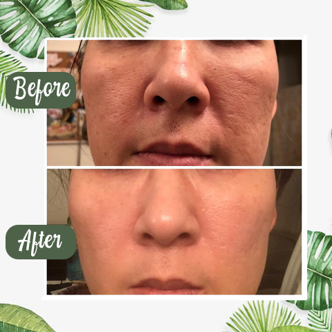 ClearVera™ — Unlock Deep Detox for Silky, Shine-Free Skin You’ll Love to Touch
