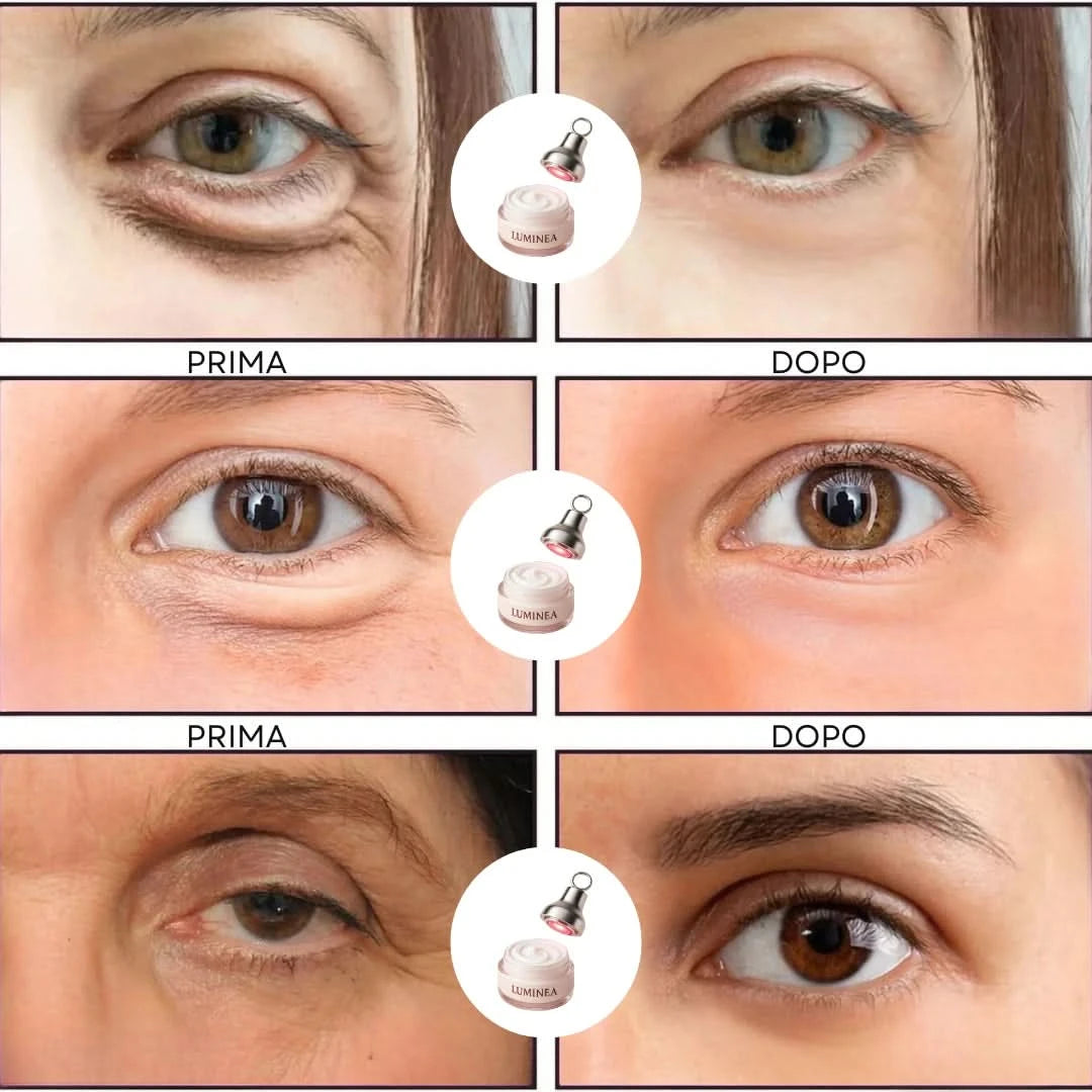 LunaVista™ — Reveal Bright, Youthful Eyes That Demand Attention Every Day
