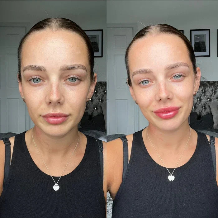 Hydrating Lip Gloss for Volume - Instant Lip Plumper Serum