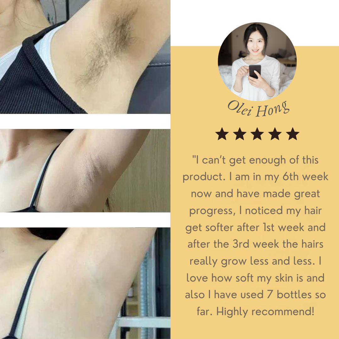 Silkaura™ — Unlock Irresistible, Itch-Free Skin That Turns Heads Instantly