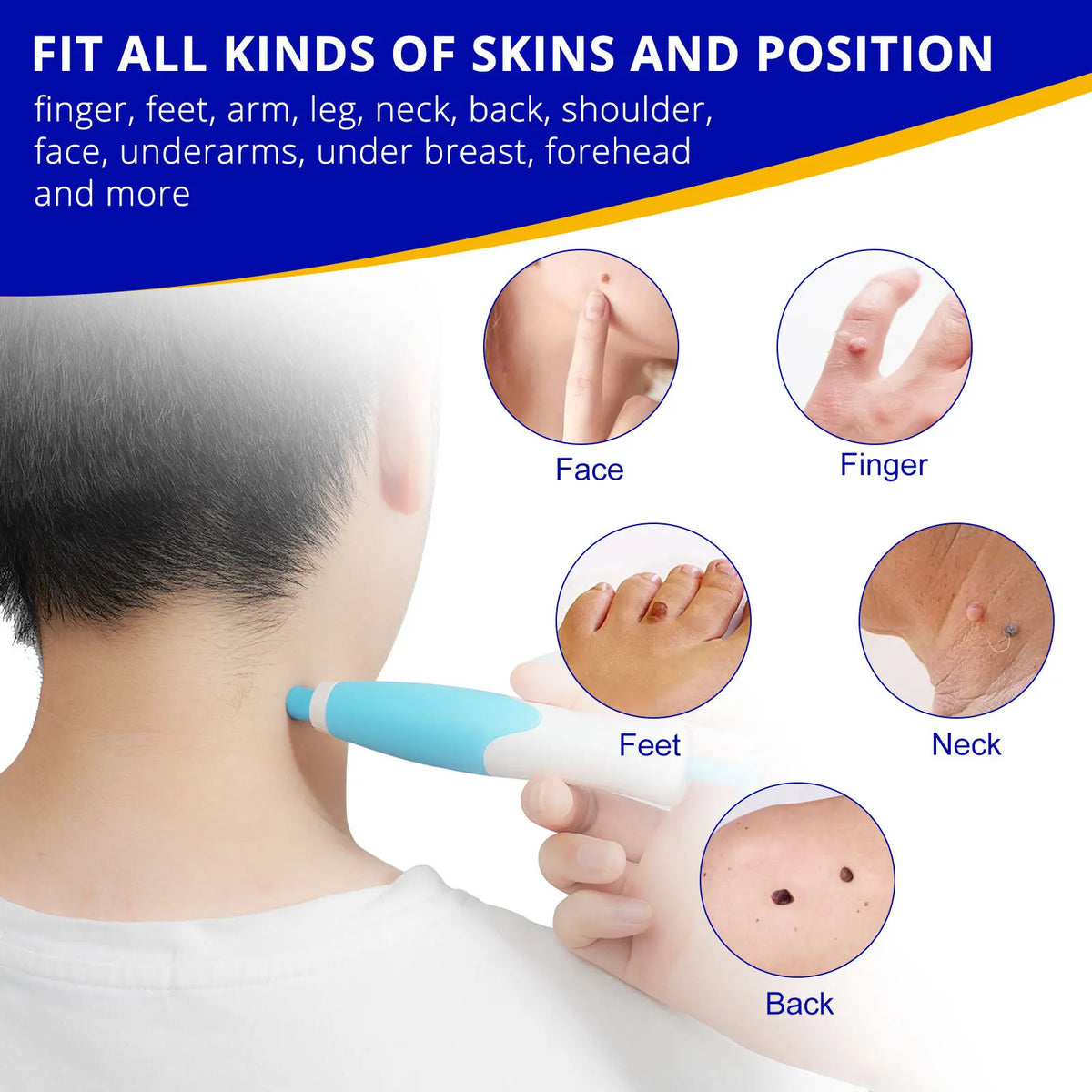 Painless Skin Spot Removal Set – No Need for Doctor's Appointment