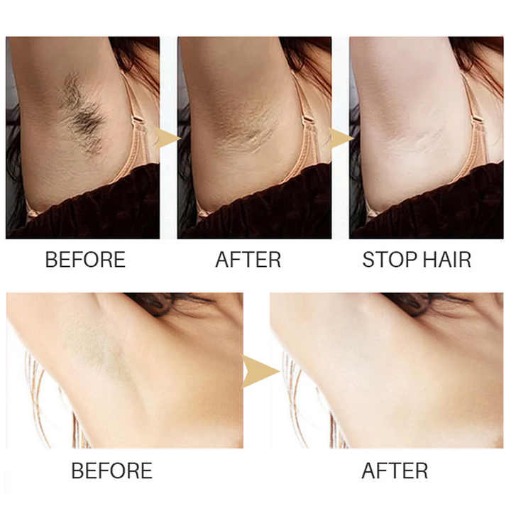 SilkEase™ — End Hair Regrowth and Reveal Silky, Irritation-Free Skin Every Day