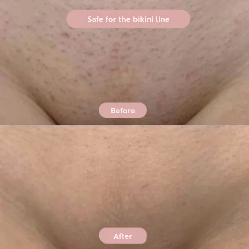 VelvetVeil™ — Glide Into Silky Smooth Confidence Without a Single Irritation