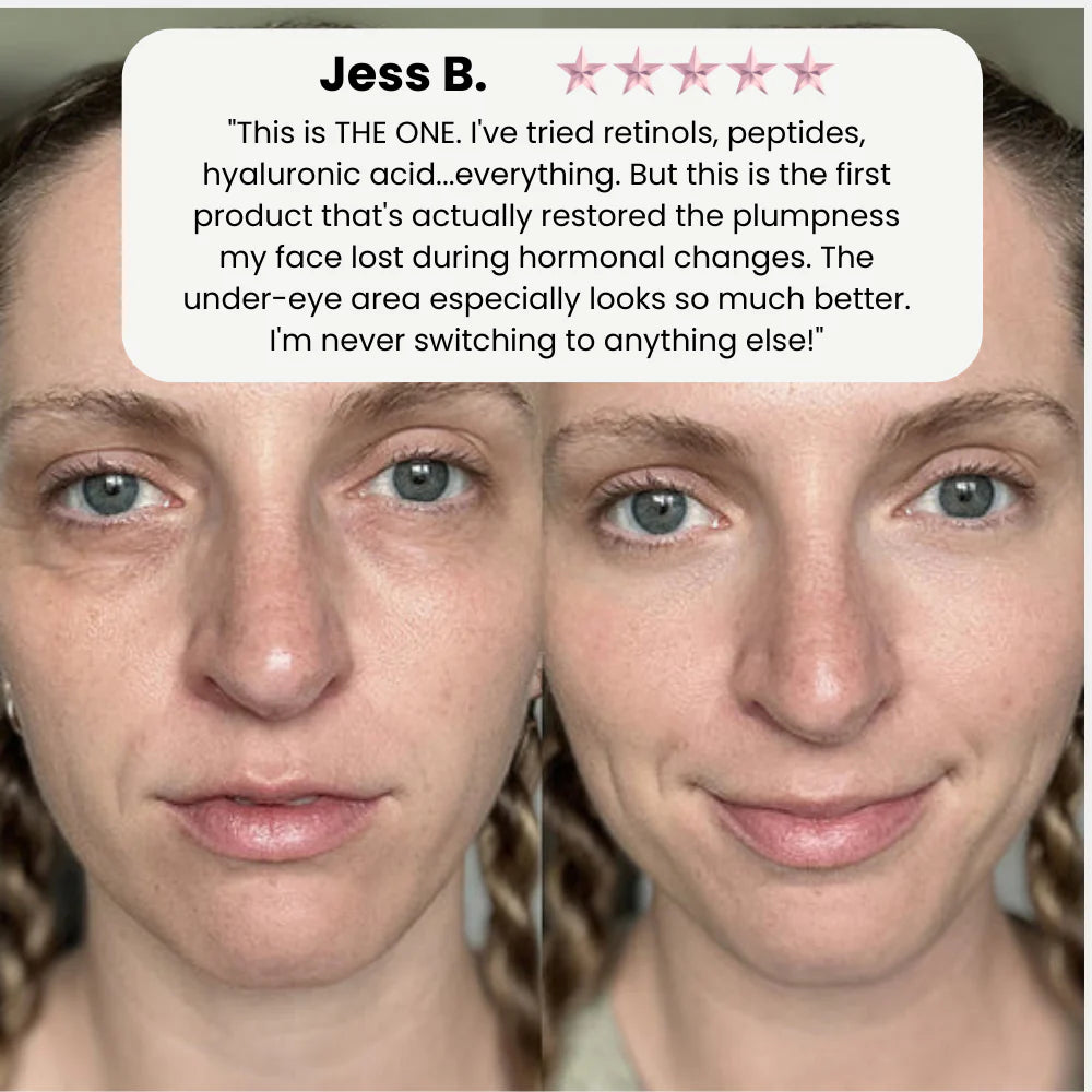 Instant Skin Lift for Youthful, Plump Appearance - Radiate Confidence