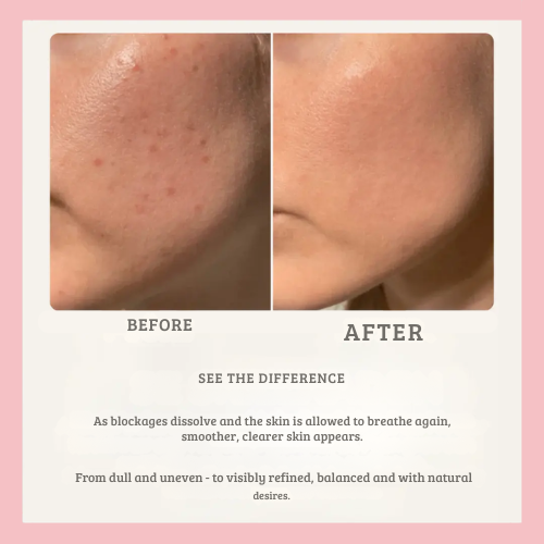 LuminoPure™ — Unlock Your Skin’s Natural Glow by Clearing Away Hidden Clogs