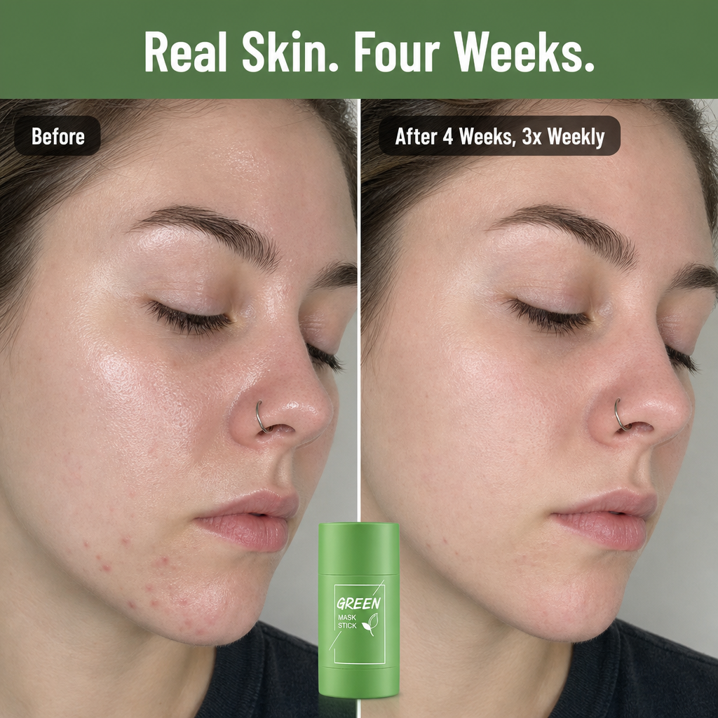 GlowStream™ — Twist On a 15-Minute Pore Reset for Combo Skin