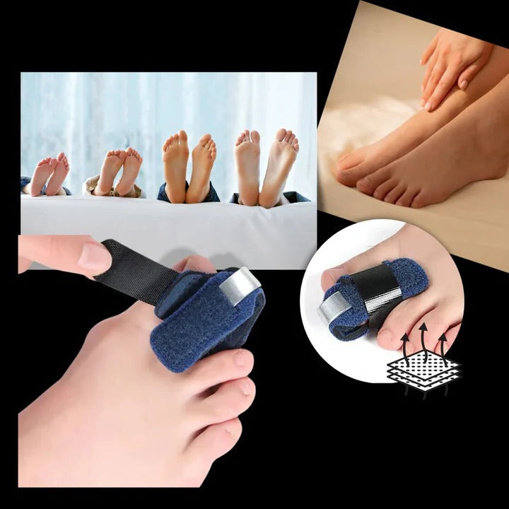 Adjustable Toe Alignment Support Brace with Flexible Bars for Daily Use