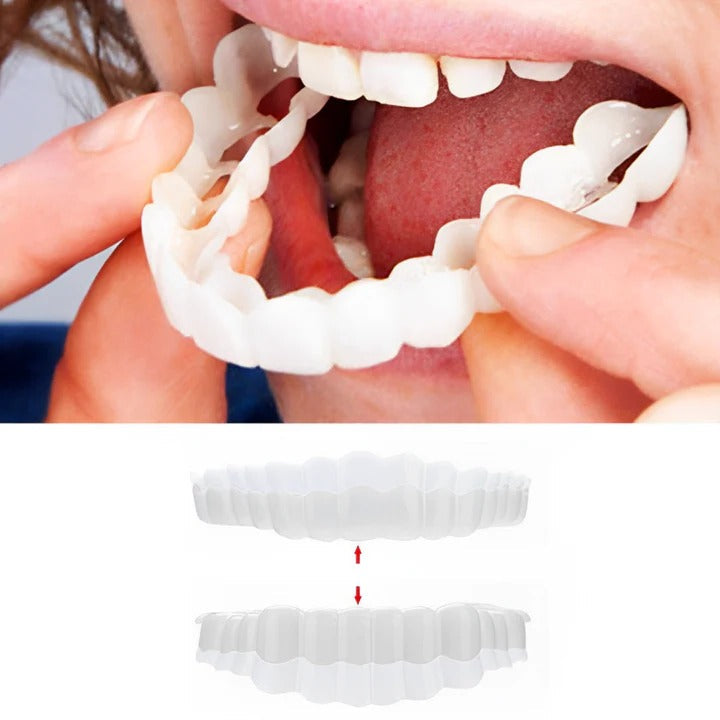Teeth Veneer Set for Upper and Lower Coverage - Clip-On Design
