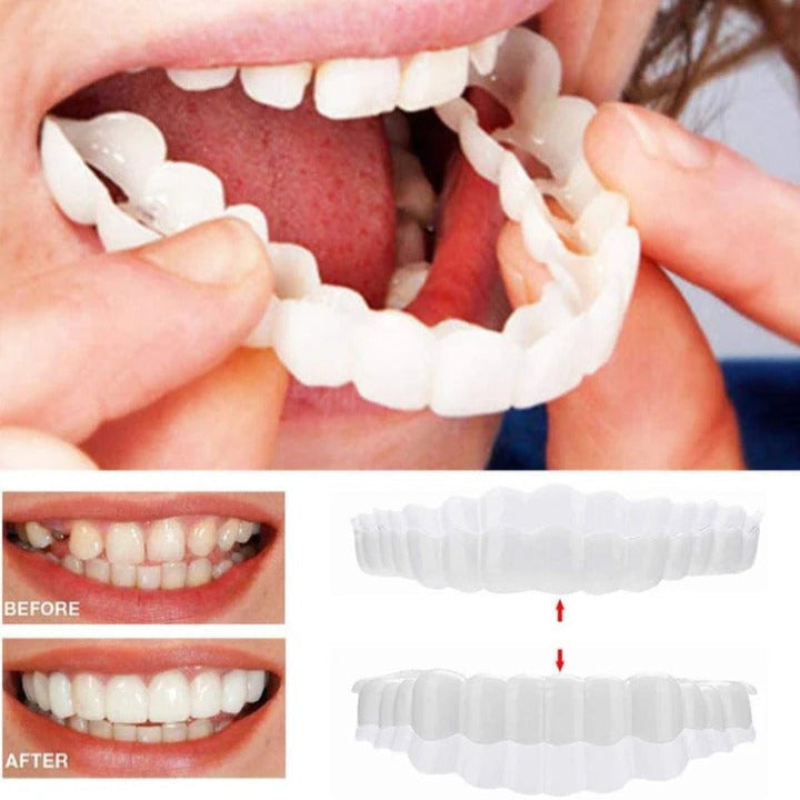 Teeth Veneer Set for Upper and Lower Coverage - Clip-On Design