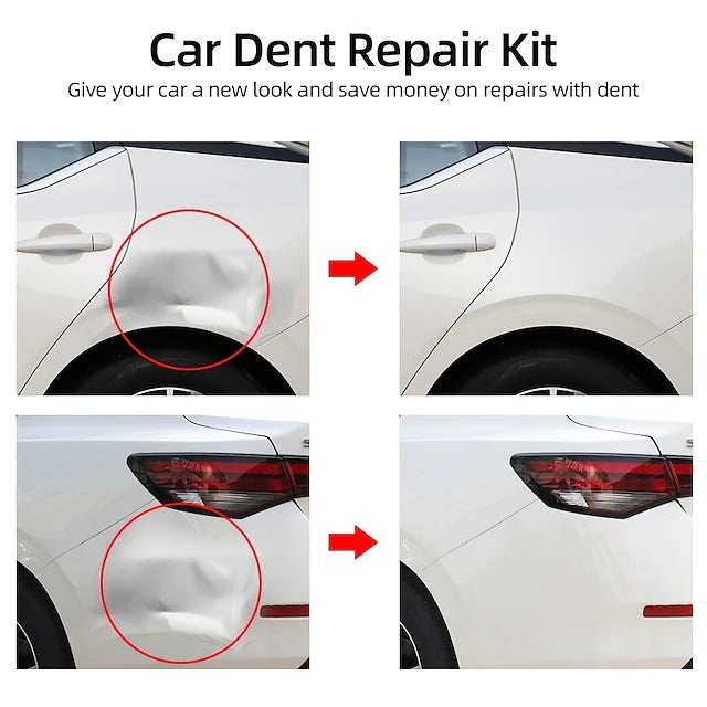 Heavy Duty Suction Cup Dent Puller Kit for Auto Body Repair