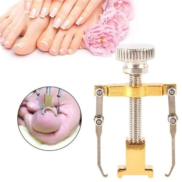 Stainless Steel Nail Care Set - 2 Toenail Correction Clips with Straightener