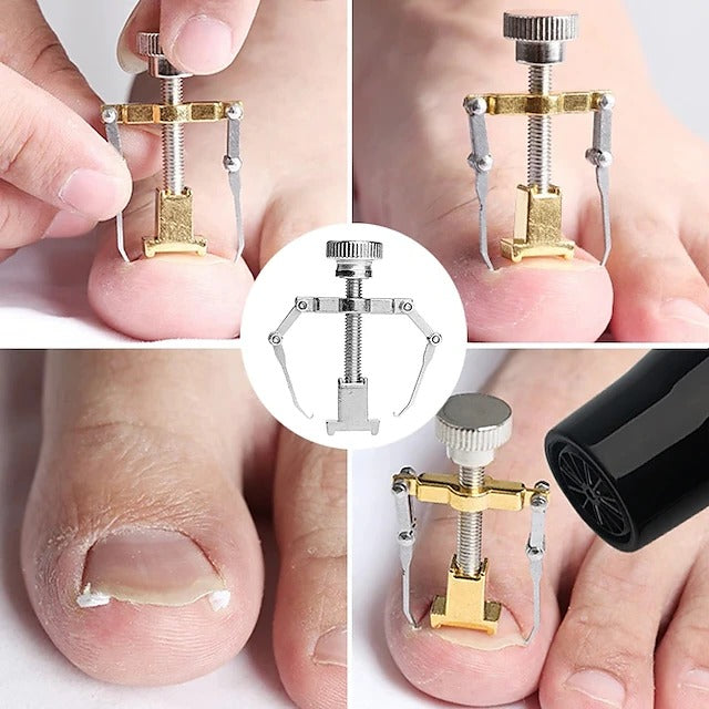 Stainless Steel Nail Care Set - 2 Toenail Correction Clips with Straightener
