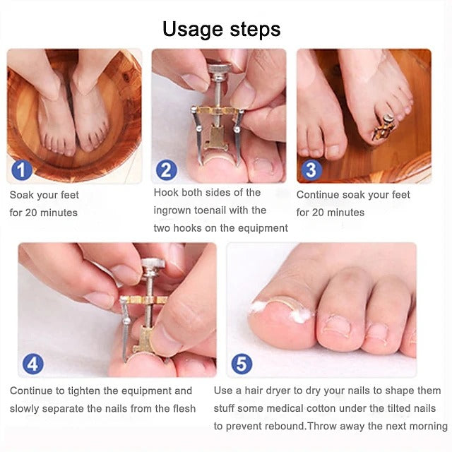 Stainless Steel Nail Care Set - 2 Toenail Correction Clips with Straightener