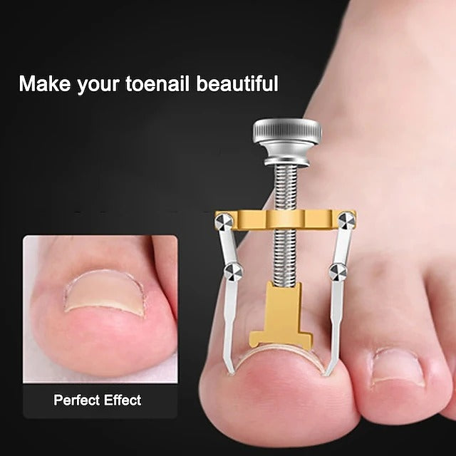 Stainless Steel Nail Care Set - 2 Toenail Correction Clips with Straightener